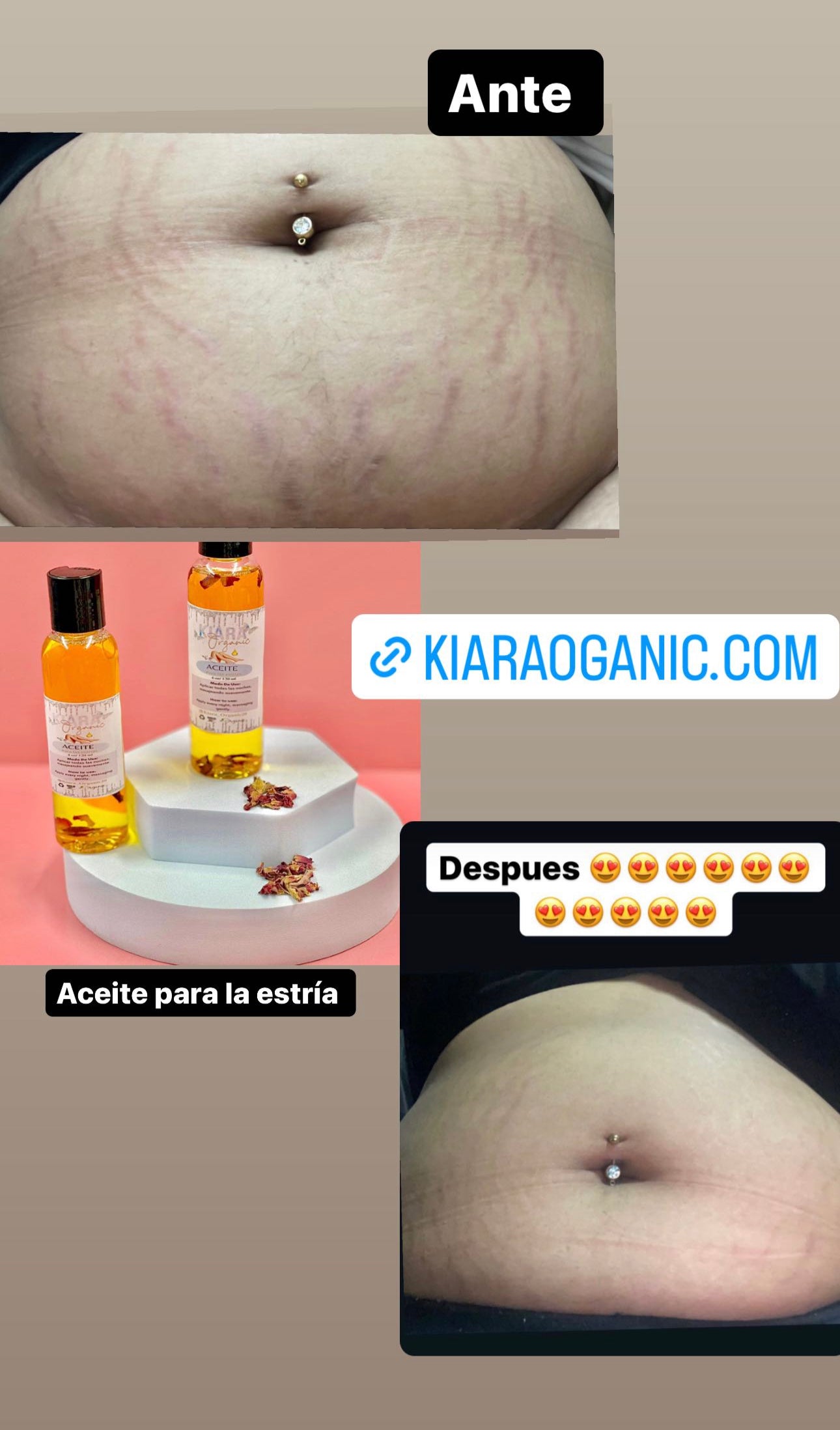 Aceite para la Estria